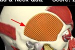 Head & Neck Quiz (iPhone/iPod)