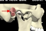 Head & Neck Quiz (iPhone/iPod)