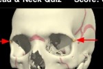 Head & Neck Quiz (iPhone/iPod)