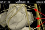 Anatomy Knee Quiz (iPhone/iPod)