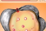 MrPimple (iPhone/iPod)