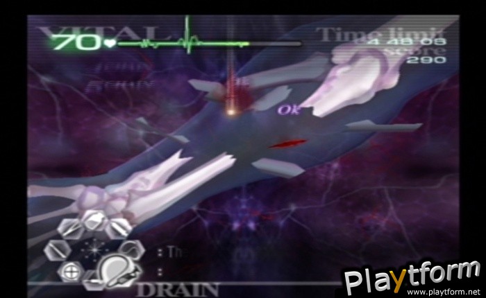 Trauma Center: Second Opinion (Wii)