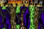 Castlevania Chronicles (PlayStation)